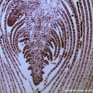 Mikroskop-Aufnahme einer Baumknopse in 40-facher Vergrößerung.